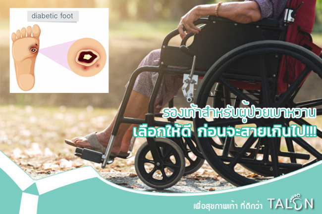 รองเท้าสำหรับผู้ป่วยเบาหวาน