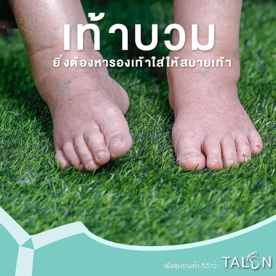 My Image 5