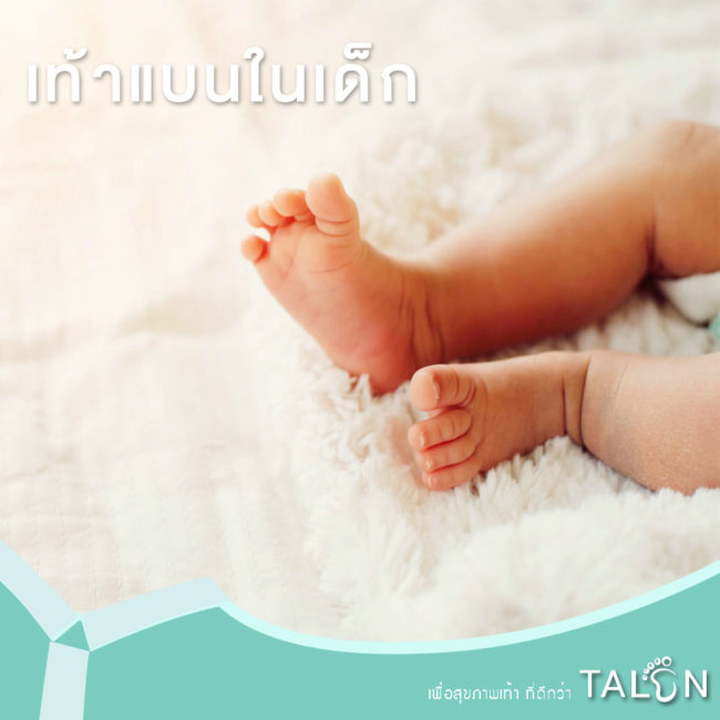 เท้าแบนในเด็ก