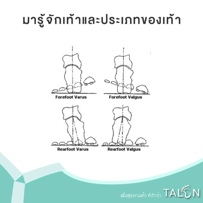 มารู้จักเท้าและประเภทของเท้า มารู้จักเท้าและประเภทของเท้า