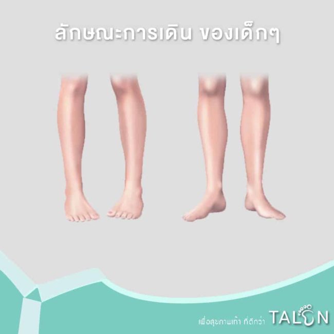 ลักษณะการเดิน-ของเด็กๆ ลักษณะการเดิน ของเด็กๆ