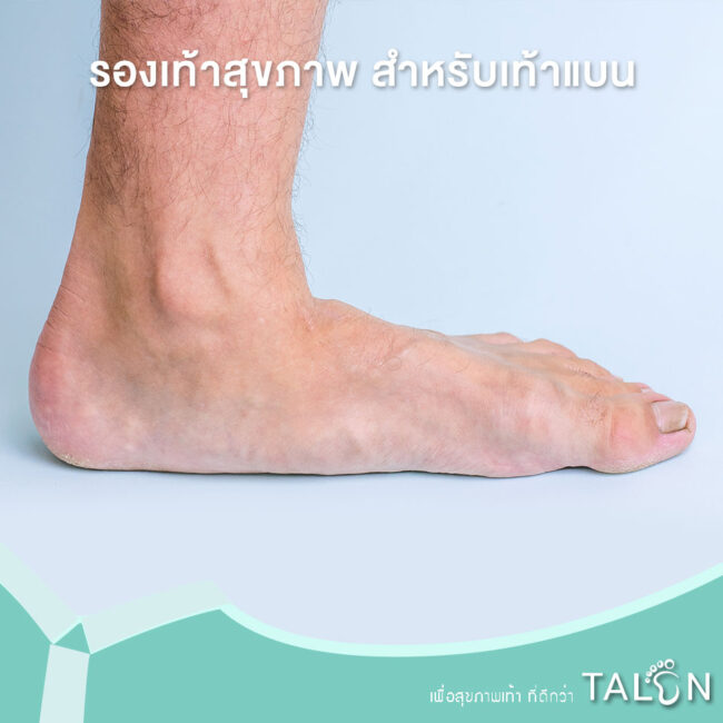 รองเท้าสุขภาพ-สำหรับเท้าแบน รองเท้าสุขภาพ-สำหรับเท้าแบน